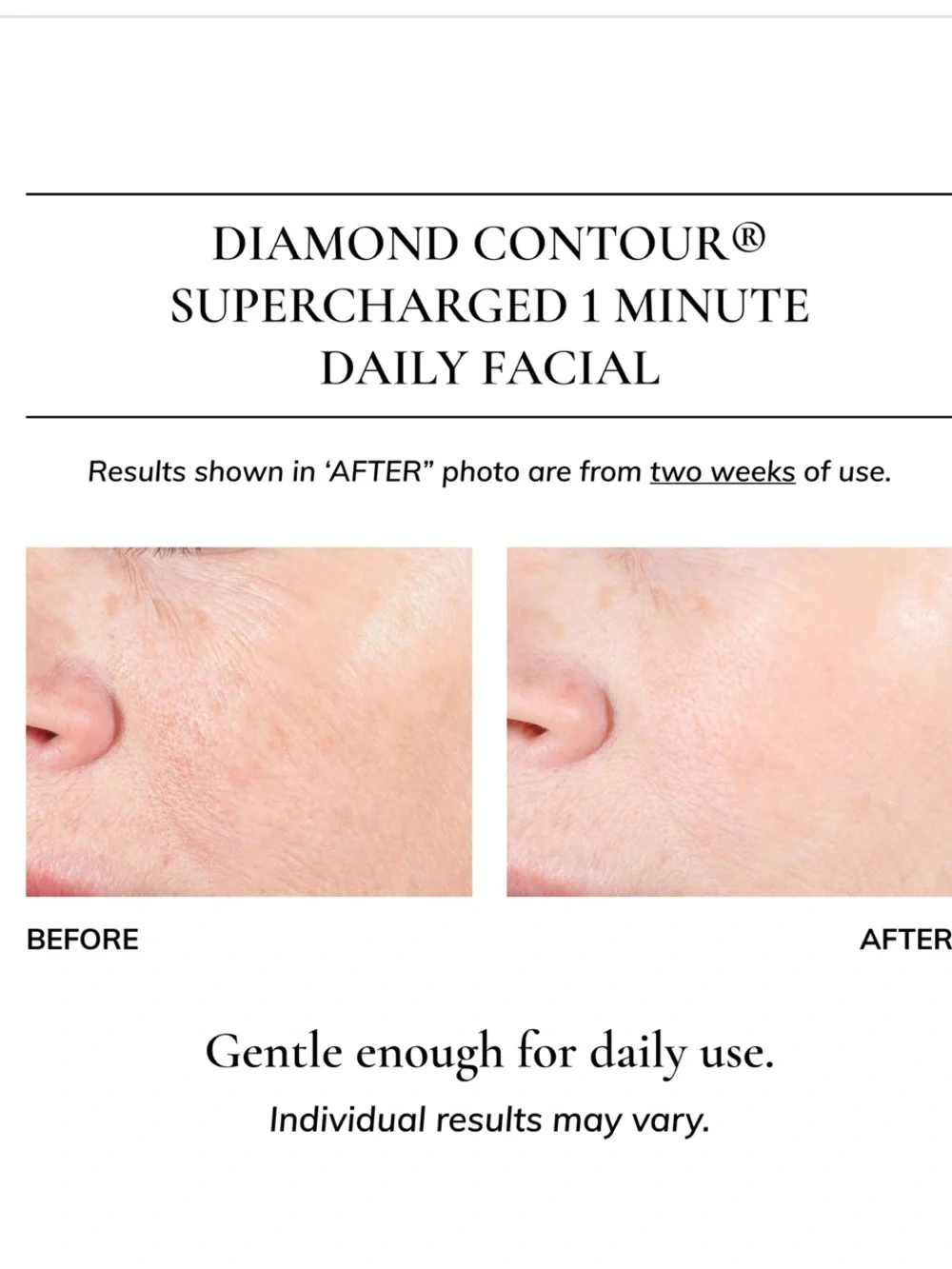 Kaplan MD Diamond Contour Supercharged 1 Minute Daily Facial 6oz/180ml